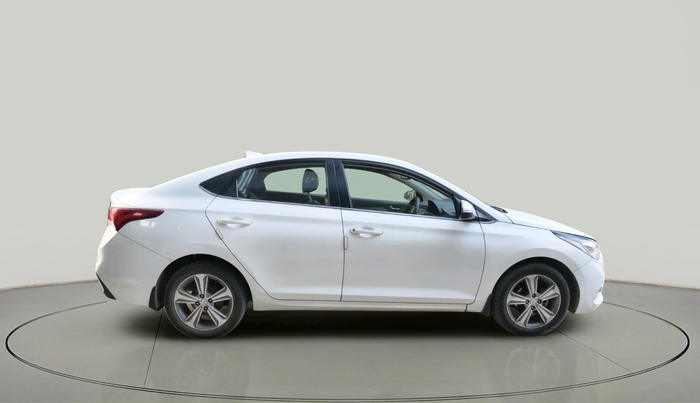 2017 Hyundai Verna 1.6 CRDI SX + AT, Diesel, Automatic, 1,55,855 km, exterior
