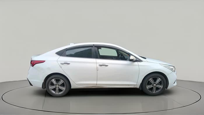 2018 Hyundai Verna 1.6 SX (O) CRDI MT, Diesel, Manual, 1,01,774 km, exterior