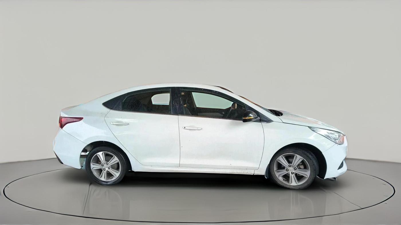 2017 Hyundai Verna 1.6 CRDI SX, Diesel, Manual, 1,07,126 km, exterior