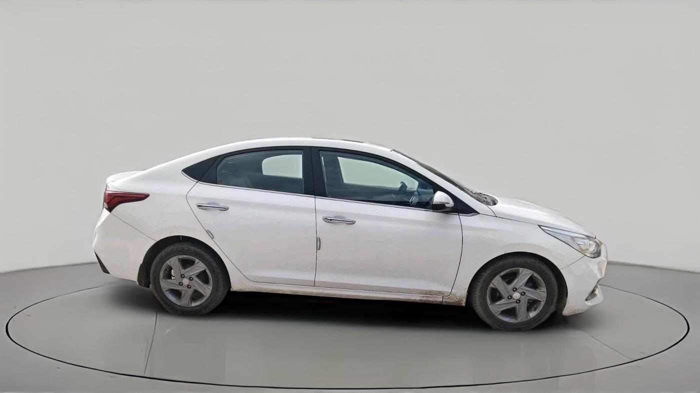 2017 Hyundai Verna 1.6 SX (O) CRDI MT, Diesel, Manual, 1,05,819 km, exterior