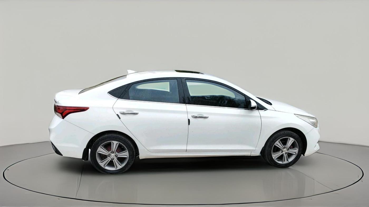 2017 Hyundai Verna 1.6 SX (O) CRDI MT, Diesel, Manual, 1,01,839 km, exterior